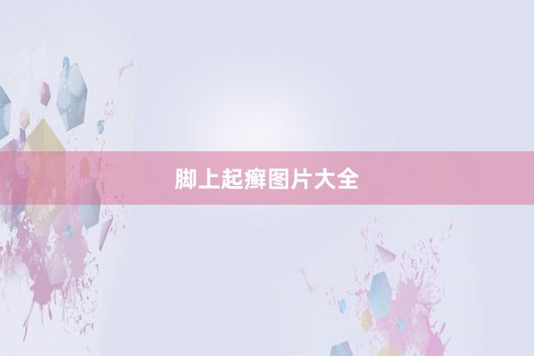 脚上起癣图片大全